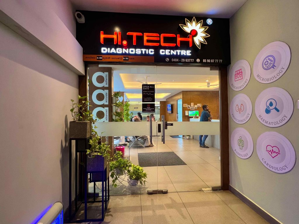 Hi-Tech Diagnostic Centre Pallikkara