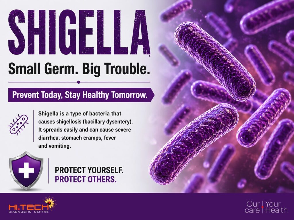 shigella-test-in-kochi