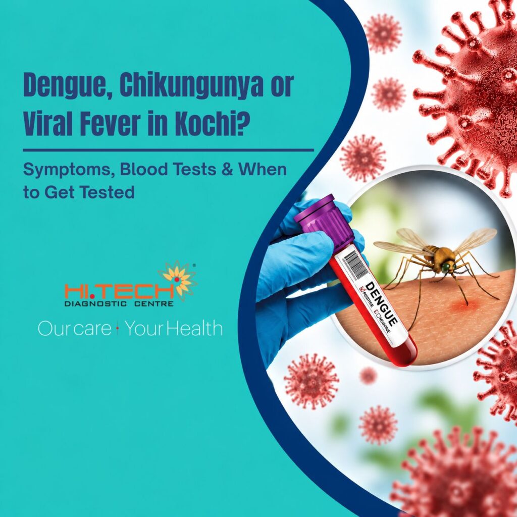 Dengue Test in Kochi