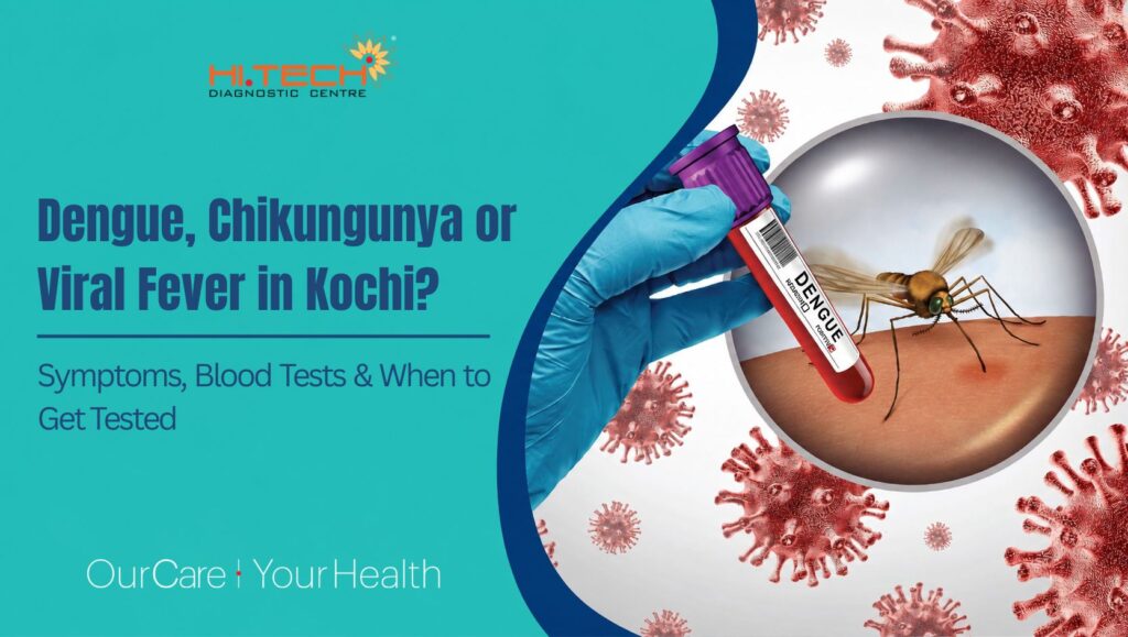 Dengue Test in Kochi